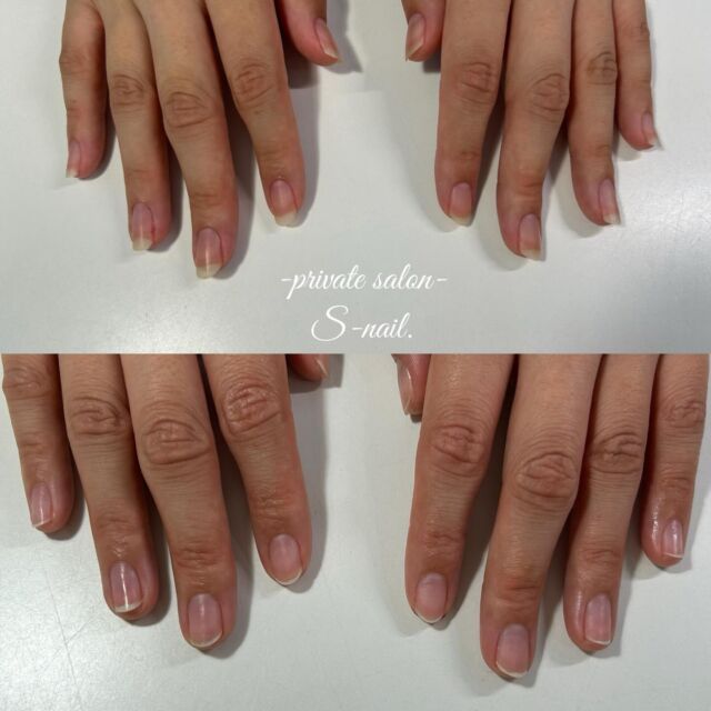 .
————————————————————
‪

- 深爪矯正/自爪育成に特化したsalon -
.
深爪噛み癖むしり癖凹凸のあるお爪に
お悩みの方ぜひ一度ご相談ください。
.
.
▫️大阪/天王寺区　各線天王寺駅徒歩3分
▫️10:30〜18:00
▫️LINE  @855rjbic
▫️定休日⤑日曜日・月曜日

@fukazume_s_nail
@s_nail0601
private salon S-nail. 

————————————————————

#深爪矯正#深爪育成
#自爪育成#自爪育成サロン
#天王寺ネイルサロン