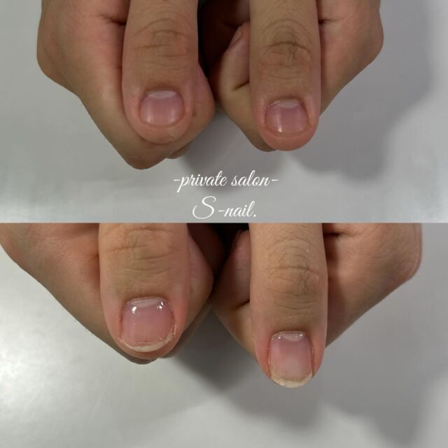 .
約半年でここまで成長しました✨️

————————————————————
‪

- 深爪矯正/自爪育成に特化したsalon -
.
深爪噛み癖むしり癖凹凸のあるお爪に
お悩みの方ぜひ一度ご相談ください。
.
.
▫️大阪/天王寺区　各線天王寺駅徒歩3分
▫️10:30〜18:00
▫️LINE  @855rjbic
▫️定休日⤑日曜日・月曜日

@fukazume_s_nail
@s_nail0601
private salon S-nail. 

————————————————————

#深爪矯正#深爪育成
#自爪育成#自爪育成サロン
#天王寺ネイルサロン